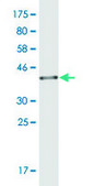 Monoclonal Anti-MUC1 antibody produced in mouse clone 1B7, purified immunoglobulin, buffered aqueous solution