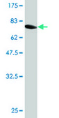 Monoclonal Anti-FH, (C-terminal) antibody produced in mouse clone 3E7, purified immunoglobulin, buffered aqueous solution