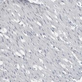 Anti-ACSF2 antibody produced in rabbit Prestige Antibodies&#174; Powered by Atlas Antibodies, affinity isolated antibody, buffered aqueous glycerol solution