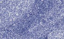 Anti-NLRP3 Antibody, clone 4B4 ZooMAb&#174; Rabbit Monoclonal recombinant, expressed in HEK 293 cells