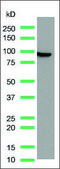 Anti-Villin antibody, Rabbit monoclonal recombinant, expressed in proprietary host, clone SP145, affinity isolated antibody