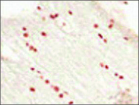 Anti-OLIG2 (AB1) antibody produced in rabbit affinity isolated antibody