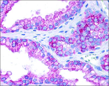 Anti-EPB41L2 antibody produced in rabbit affinity isolated antibody