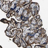 Anti-RHOT2 antibody produced in rabbit Prestige Antibodies&#174; Powered by Atlas Antibodies, affinity isolated antibody, buffered aqueous glycerol solution