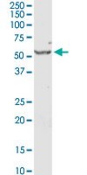 Anti-SERPINE1 antibody produced in rabbit purified immunoglobulin, buffered aqueous solution