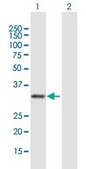 Anti-RNASEH2A antibody produced in mouse purified immunoglobulin, buffered aqueous solution