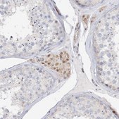 Anti-NELL2 antibody produced in rabbit Prestige Antibodies&#174; Powered by Atlas Antibodies, affinity isolated antibody, buffered aqueous glycerol solution