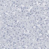 Anti-GNAS antibody produced in rabbit Prestige Antibodies&#174; Powered by Atlas Antibodies, affinity isolated antibody, buffered aqueous glycerol solution