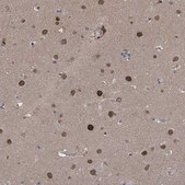 Anti-KPNB1 antibody produced in rabbit Prestige Antibodies&#174; Powered by Atlas Antibodies, affinity isolated antibody, buffered aqueous glycerol solution