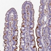 Anti-ACE antibody produced in rabbit Prestige Antibodies&#174; Powered by Atlas Antibodies, affinity isolated antibody, buffered aqueous glycerol solution