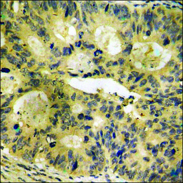 Anti-phospho-PLD2 (pTyr169) antibody produced in rabbit affinity isolated antibody