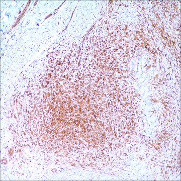 Beta-Catenin (14) Mouse Monoclonal Antibody