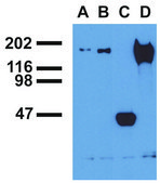 Monoclonal Anti-EGFR (PhosphoTyr1173) antibody produced in mouse clone EM-13