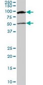 Monoclonal Anti-MECP2 antibody produced in mouse clone 4B6, purified immunoglobulin, buffered aqueous solution