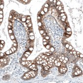 Monoclonal Anti-EPCAM antibody produced in mouse Prestige Antibodies&#174; Powered by Atlas Antibodies, clone CL6313, purified immunoglobulin, buffered aqueous glycerol solution