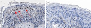 Anti-GRHL2 Antibody, clone 2N18 ZooMAb&#174; Rabbit Monoclonal recombinant, expressed in HEK 293 cells