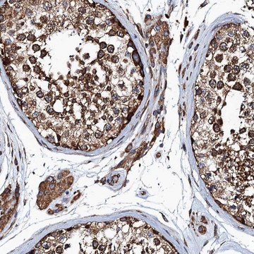 Anti-MDM1 antibody produced in rabbit Prestige Antibodies&#174; Powered by Atlas Antibodies, affinity isolated antibody, buffered aqueous glycerol solution