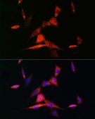 Anti-RAR&#946; Antibody, clone 6D5V4, Rabbit Monoclonal