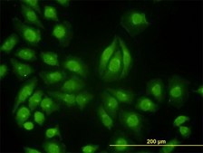 Monoclonal Anti-TYK2 antibody produced in mouse clone 6G12, purified immunoglobulin, buffered aqueous solution