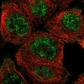 Anti-NUDCD1 antibody produced in rabbit Prestige Antibodies&#174; Powered by Atlas Antibodies, affinity isolated antibody, buffered aqueous glycerol solution