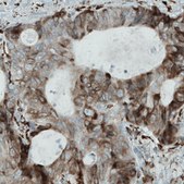 Monoclonal Anti-MTDH antibody produced in mouse Prestige Antibodies&#174; Powered by Atlas Antibodies, clone CL0397, purified immunoglobulin, buffered aqueous glycerol solution
