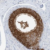 Anti-RCN2 antibody produced in rabbit Prestige Antibodies&#174; Powered by Atlas Antibodies, affinity isolated antibody, buffered aqueous glycerol solution