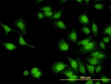 Monoclonal Anti-IRAK1, (C-terminal) antibody produced in mouse clone 3A9, purified immunoglobulin, buffered aqueous solution