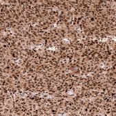 Monoclonal Anti-EZH2 antibody produced in mouse Prestige Antibodies&#174; Powered by Atlas Antibodies, clone CL11915, purified immunoglobulin, buffered aqueous glycerol solution