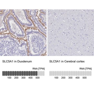 Anti-SLC5A1 antibody produced in rabbit Prestige Antibodies&#174; Powered by Atlas Antibodies, affinity isolated antibody, buffered aqueous glycerol solution