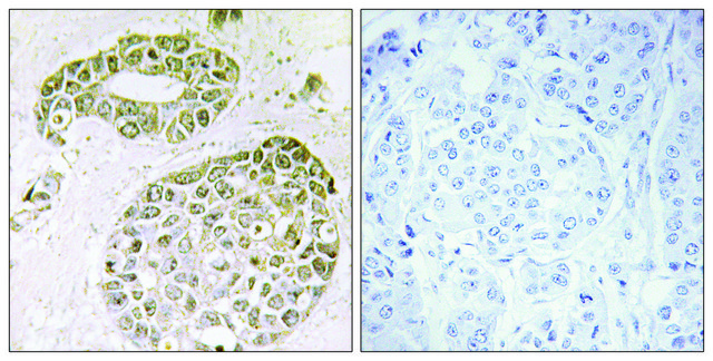 Anti-HNRNP M antibody produced in rabbit affinity isolated antibody