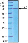 Streptolysin O from Streptococcus pyogenes &#947;-irradiated