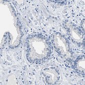 Anti-ACKR2 antibody produced in rabbit Prestige Antibodies&#174; Powered by Atlas Antibodies, affinity isolated antibody, buffered aqueous glycerol solution