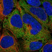 Anti-TPT1 antibody produced in rabbit Prestige Antibodies&#174; Powered by Atlas Antibodies, affinity isolated antibody, buffered aqueous glycerol solution