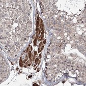 Anti-RANBP3L antibody produced in rabbit Prestige Antibodies&#174; Powered by Atlas Antibodies, affinity isolated antibody, buffered aqueous glycerol solution