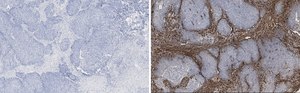 Anti-TAGLN Antibody, clone 1D10 , ZooMAb&#174; Rabbit Monoclonal recombinant, expressed in HEK 293 cells