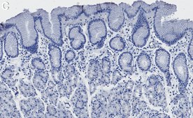 Anti-NQO1 Antibody, clone 1D12 ZooMAb&#174; Rabbit Monoclonal recombinant, expressed in HEK 293 cells