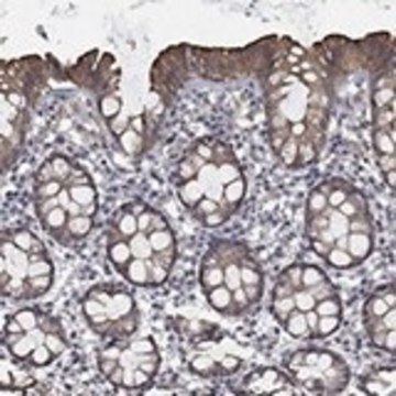 Anti-CHST5 antibody produced in rabbit Prestige Antibodies&#174; Powered by Atlas Antibodies, affinity isolated antibody, buffered aqueous glycerol solution