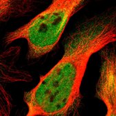 Anti-EP300 antibody produced in rabbit Ab1, Prestige Antibodies&#174; Powered by Atlas Antibodies, affinity isolated antibody, buffered aqueous glycerol solution