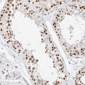 Anti-SMARCA2 antibody produced in rabbit Prestige Antibodies&#174; Powered by Atlas Antibodies, affinity isolated antibody, buffered aqueous glycerol solution