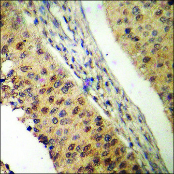 Anti-phospho-APC1 (pSer688) antibody produced in rabbit affinity isolated antibody