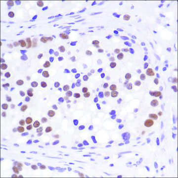 Anti-Androgen Receptor (C-term) antibody, Rabbit monoclonal clone SP242, recombinant, expressed in proprietary host, affinity isolated antibody