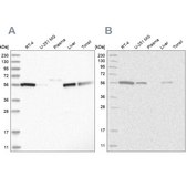 Anti-ALDH5A1 antibody produced in rabbit Prestige Antibodies&#174; Powered by Atlas Antibodies, affinity isolated antibody, buffered aqueous glycerol solution, ab1