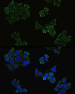 Anti-Phospho-AKT1-T308 antibody produced in rabbit