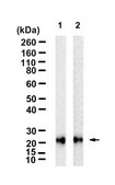 Anti-Lipocalin-2/NGAL Antibody, clone 1E3 ZooMAb&#174; Rabbit Monoclonal recombinant, expressed in HEK 293 cells