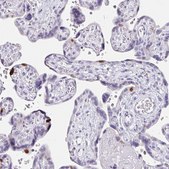 Anti-ANLN antibody produced in rabbit Prestige Antibodies&#174; Powered by Atlas Antibodies, affinity isolated antibody, buffered aqueous glycerol solution
