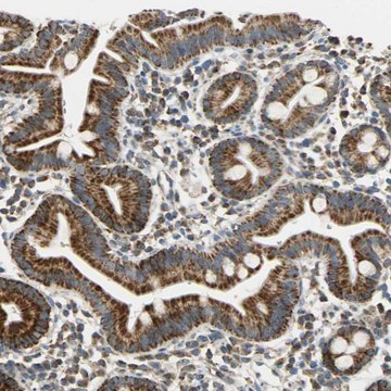 Anti-HDHD5 antibody produced in rabbit Prestige Antibodies&#174; Powered by Atlas Antibodies, affinity isolated antibody, buffered aqueous glycerol solution