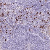 Anti-MCUB antibody produced in rabbit Prestige Antibodies&#174; Powered by Atlas Antibodies, affinity isolated antibody, buffered aqueous glycerol solution