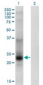 Monoclonal Anti-TSPAN8 antibody produced in mouse clone 1E5, purified immunoglobulin, buffered aqueous solution