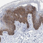 Anti-KRT14 antibody produced in rabbit Prestige Antibodies&#174; Powered by Atlas Antibodies, affinity isolated antibody, buffered aqueous glycerol solution