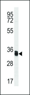ANTI-TMX1(C-TERMINAL) antibody produced in rabbit affinity isolated antibody, buffered aqueous solution